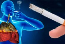 Tabaquismo, principal factor de riesgo para desarrollar cáncer de pulmón