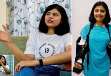 Manos de hombre trasplantadas a una mujer se volvieron más femeninas con el paso del tiempo